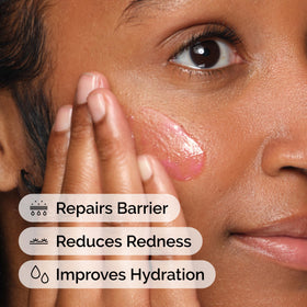 The Ordinary Soothing & Barrier Support Serum bottle with dropper