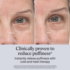 TheraFace Depuffing Wand being used on under-eye area