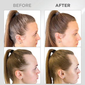 Thick Fiber Root Touch Up Powder application on hairline