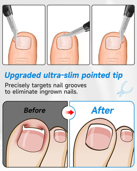 Tisojpod Nail Clippers with protective blade cover