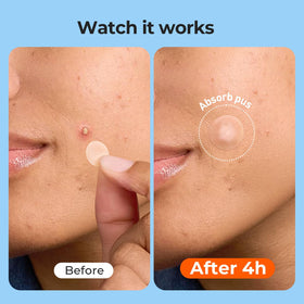 TKTK Hydrocolloid Pimple Patches packaging details