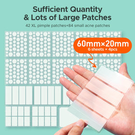 TKTK Large Pimple Patches with a hand holding a patch