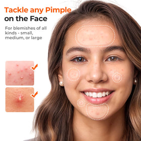 TKTK Pimple Patch application on skin