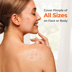 TKTK Pimple Patches with individual packaging
