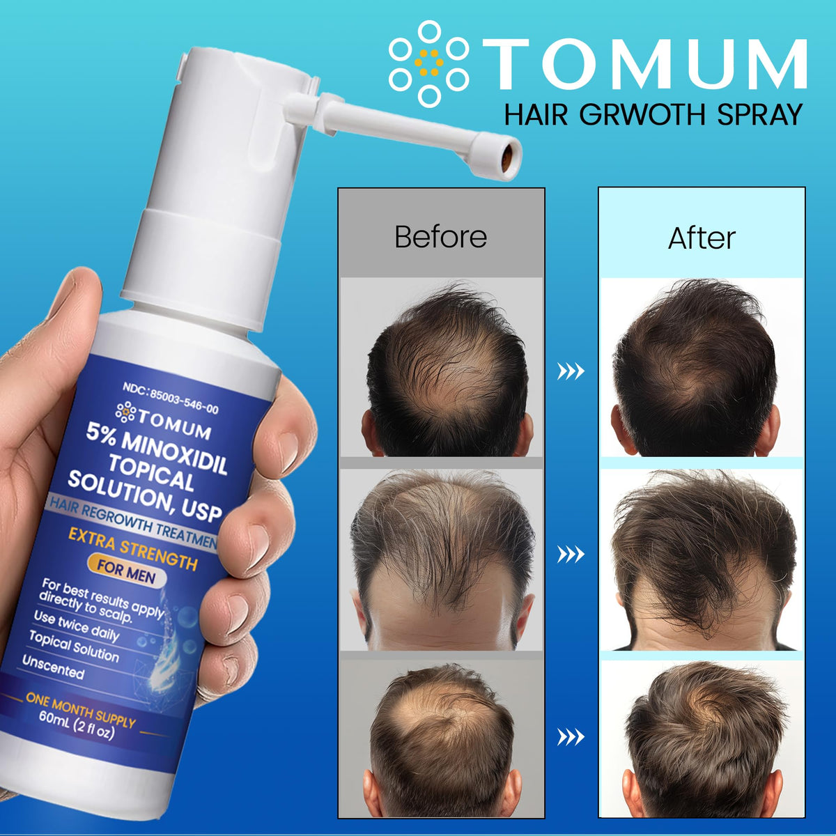 TOMUM Minoxidil Spray showing usage instructions