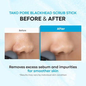 TONYMOLY Tako Pore Scrub Stick Duo in travel bag