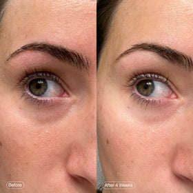 Topicals Under Eye Masks in a refrigerator for cooling