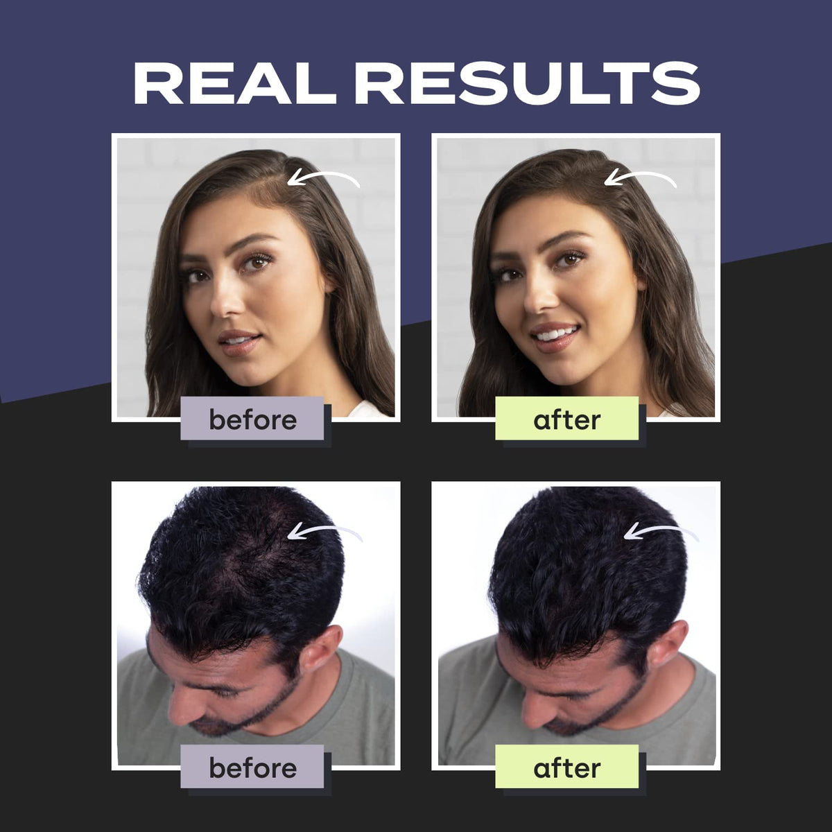 TOPPIK Hair Building Fibers application process