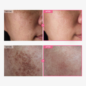 TOSOWOONG Arbutin 7% Cream texture close-up