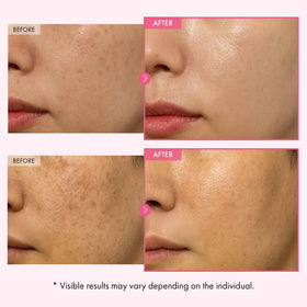 TOSOWOONG Arbutin 7% Glutathione Cream application on skin
