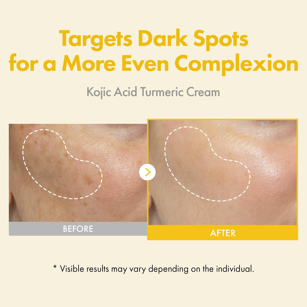 TOSOWOONG Kojic Acid Turmeric Cream texture close-up