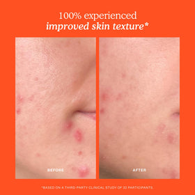 Tower 28 SOS Recovery Hydrating Face Cream application on skin