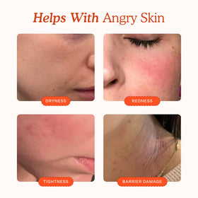 Tower 28 SOS Recovery Hydrating Face Cream packaging side view