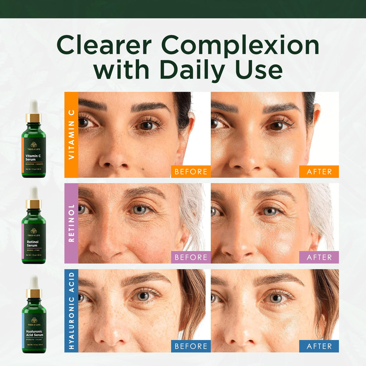Tree of Life Face Serum Set packaging with ingredients list