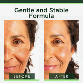 Tree of Life Niacinamide Serum texture on skin