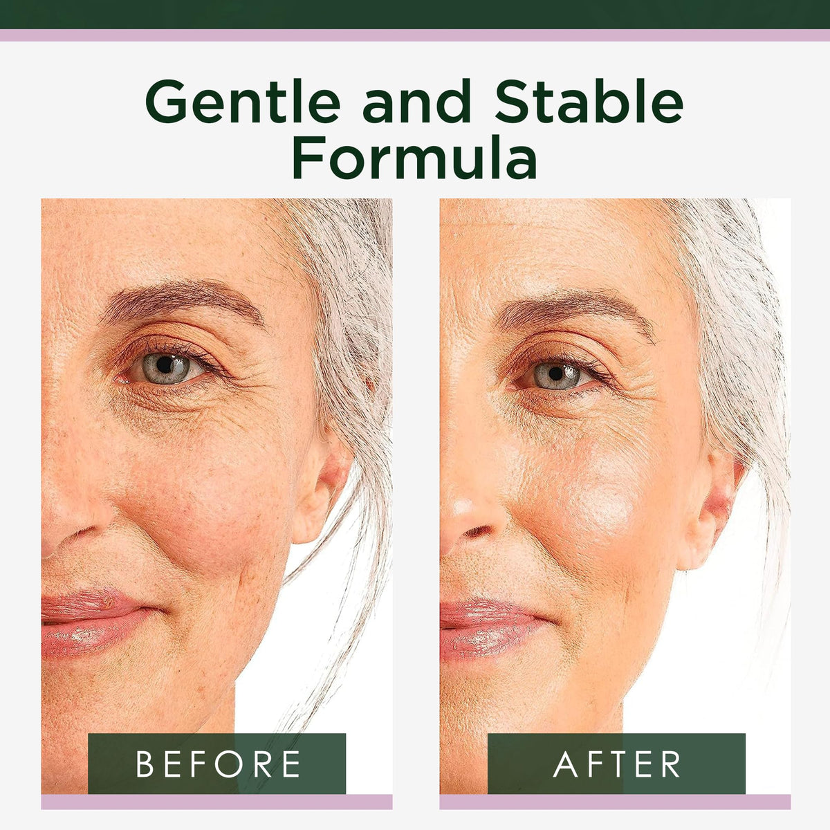Tree of Life Retinol Serum application on skin