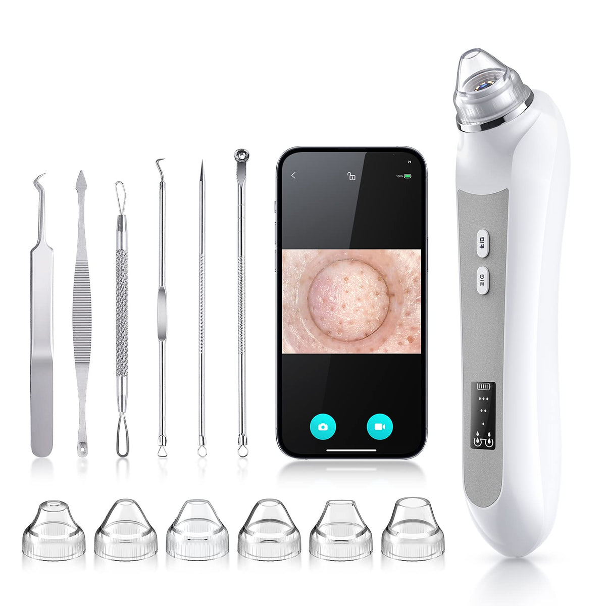 TTozka Blackhead Remover Vacuum front view with HD camera