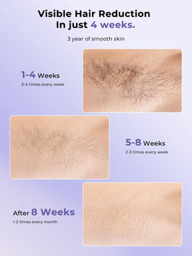 Ubroo IPL Hair Removal Machine in lifestyle setting on a vanity
