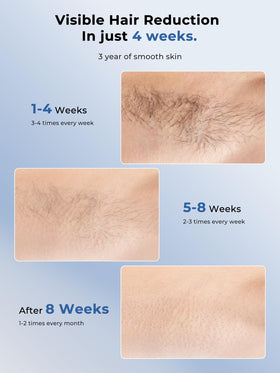 Ubroo Laser Hair Removal Device in use on leg
