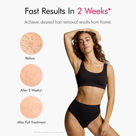 Ulike Air 10 IPL hair removal device in lifestyle setting