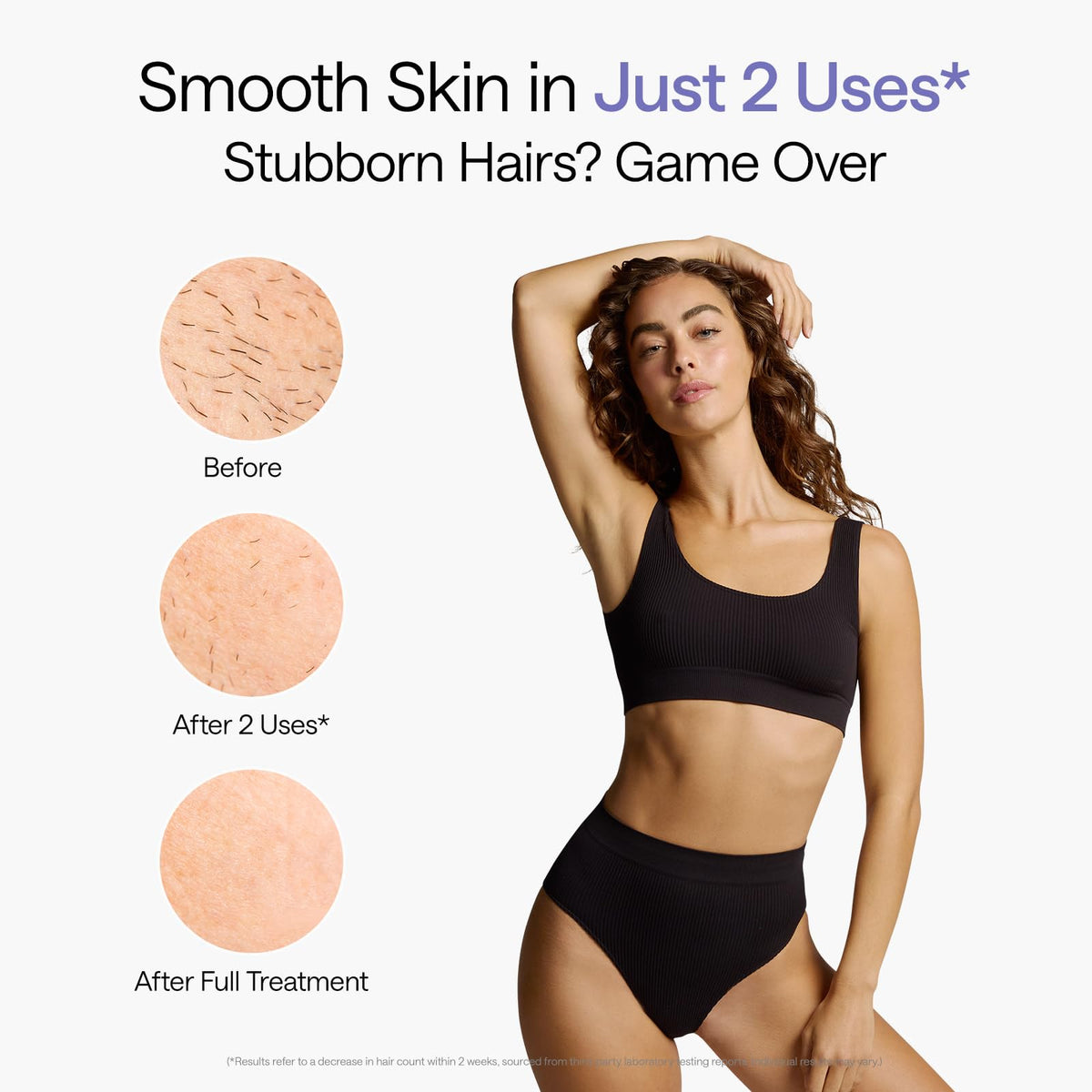 Ulike Air 10 IPL Hair Removal Device in use on legs