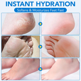 Uruses Urea Cream 60% stick with a hand applying
