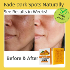 Uselective Lemon & Turmeric Soap Bar in use on skin