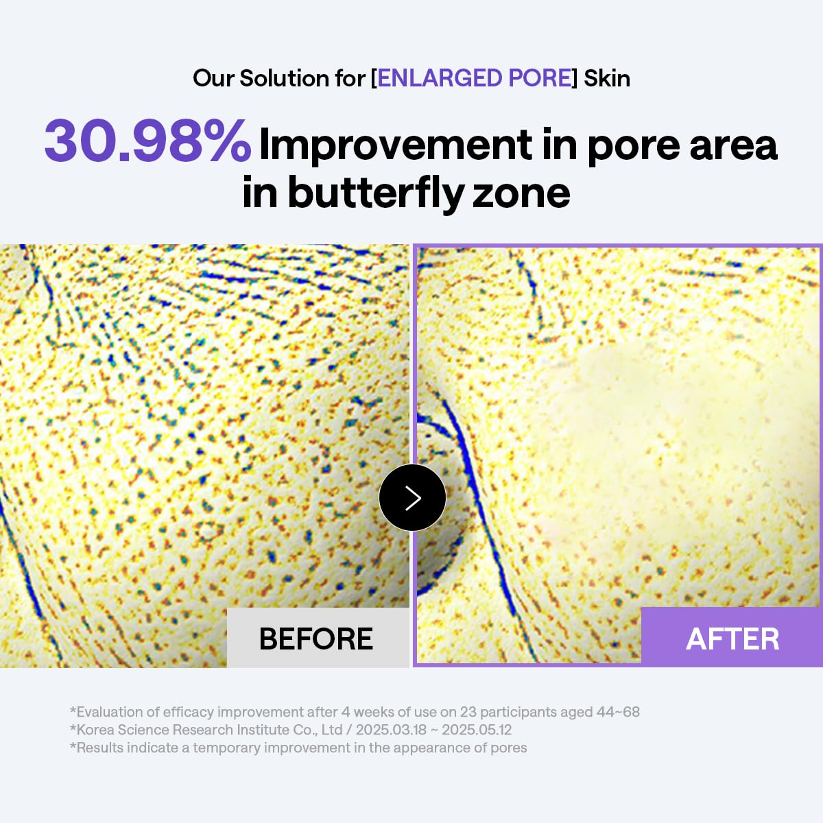Using MEDIHEAL PDRN Lifting Toner Pad on face
