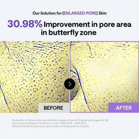 Using MEDIHEAL PDRN Lifting Toner Pad on face