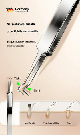 UWOIST Pimple Popper Tool Kit displayed with tools