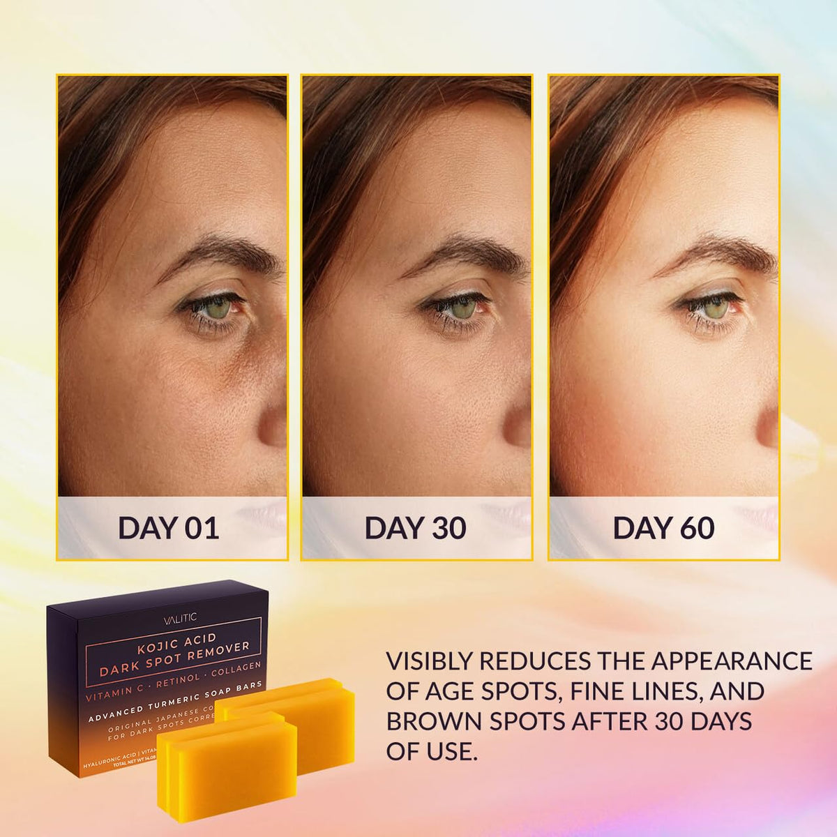 VALITIC Kojic Acid Soap Bar with Vitamin C and Turmeric