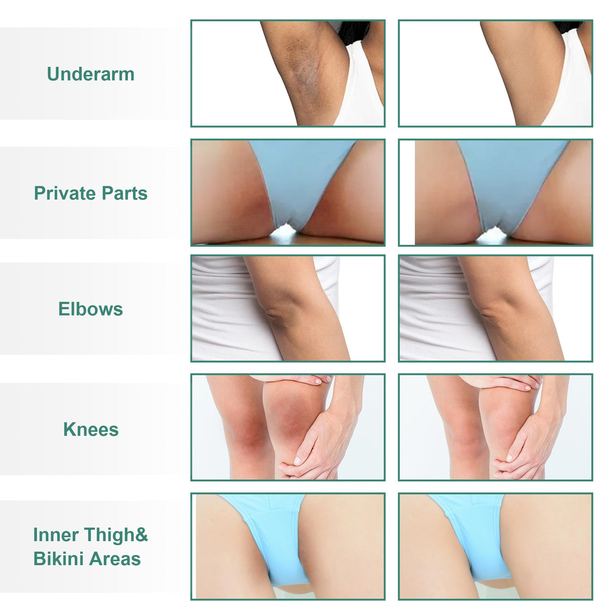 Vcetree Skin Bleaching Cream packaging side view