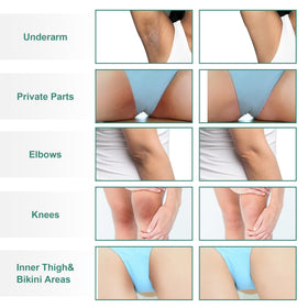 Vcetree Skin Bleaching Cream packaging with ingredients