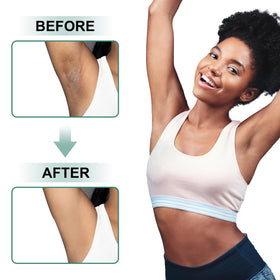 Vcetree Skin Bleaching Cream with vitamin E label