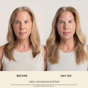 VEGAMOUR GRO+ Advanced Balancing Shampoo 280g back view