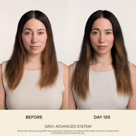 VEGAMOUR GRO+ Advanced Balancing Shampoo 280g in bathroom setting