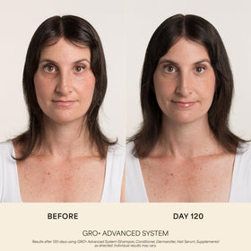 VEGAMOUR GRO+ Advanced Balancing Shampoo 280g side view