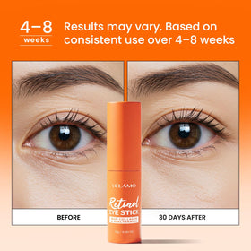 VELAMO ADVANCED Retinol Eye Balm Stick application on under-eye area