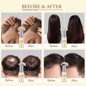 Venanoci Hair Growth Oil bottle with dropper