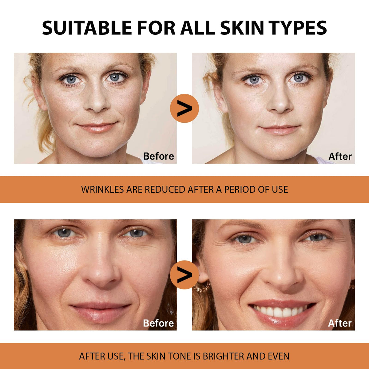 VGO Vitamin C Serum with hyaluronic acid