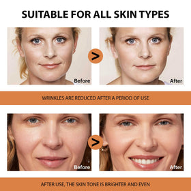 VGO Vitamin C Serum with hyaluronic acid
