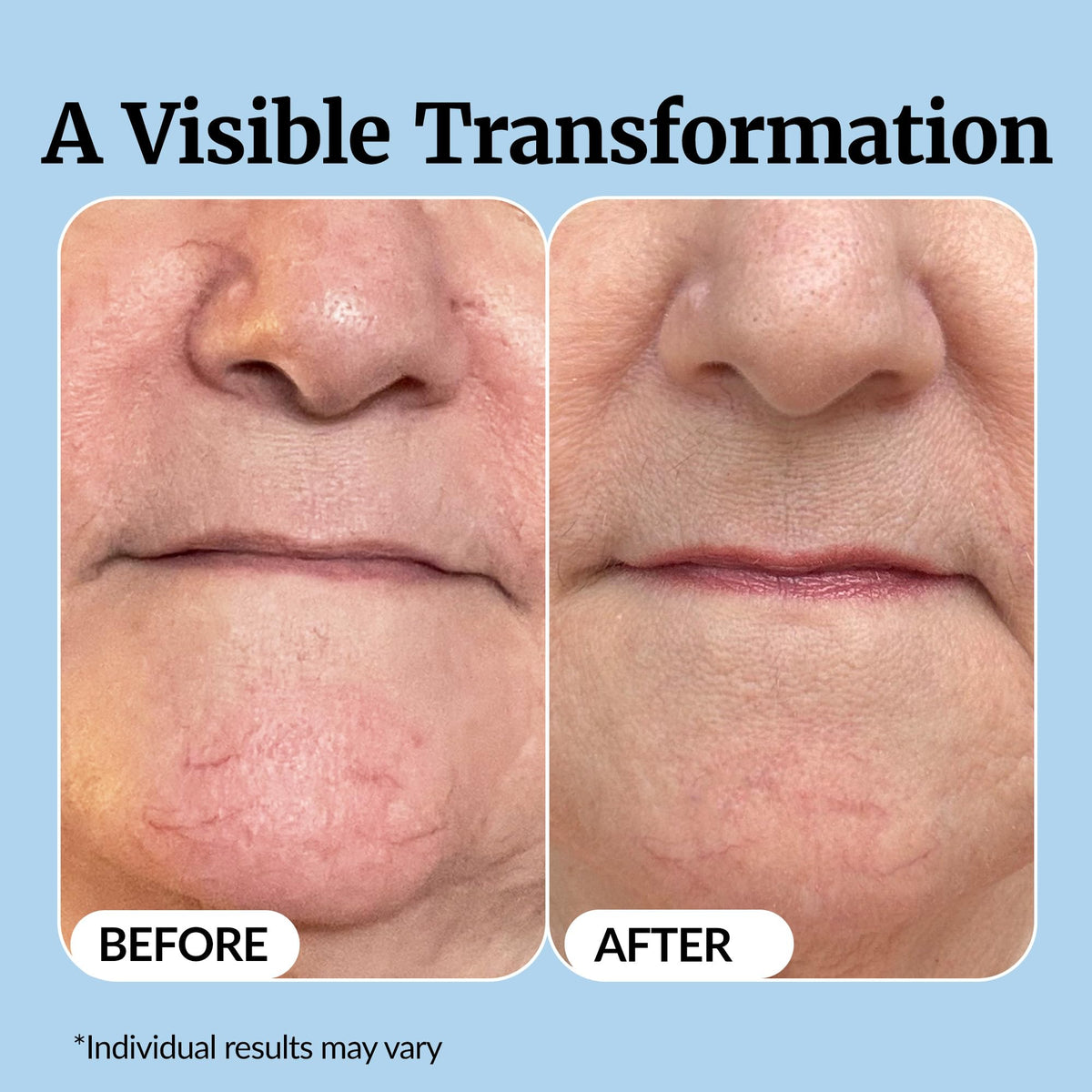 Vibriance Super C Vitamin C Serum lifestyle scene