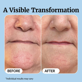 Vibriance Super C Vitamin C Serum lifestyle scene