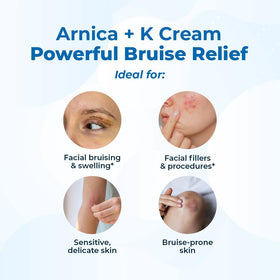 VitaMedica Arnica + Vitamin K Oxide Cream back view showing ingredients