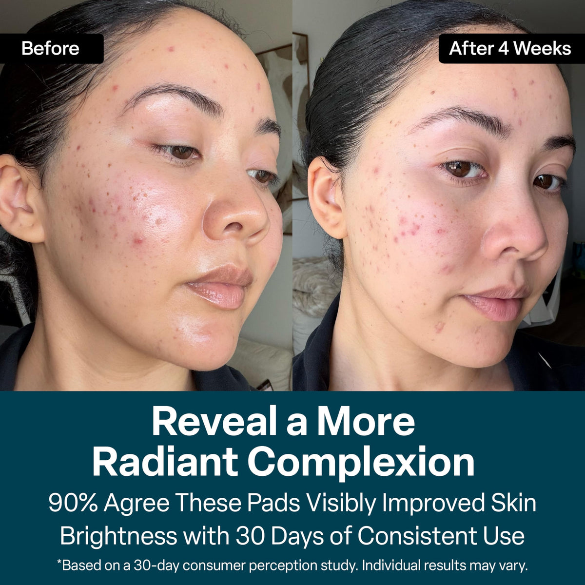 Vitamins B5, C, and E listed on QRxLabs Glycolic Acid Pads packaging