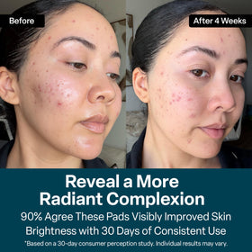 Vitamins B5, C, and E listed on QRxLabs Glycolic Acid Pads packaging