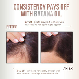Vitamo Premium Batana Oil packaging details