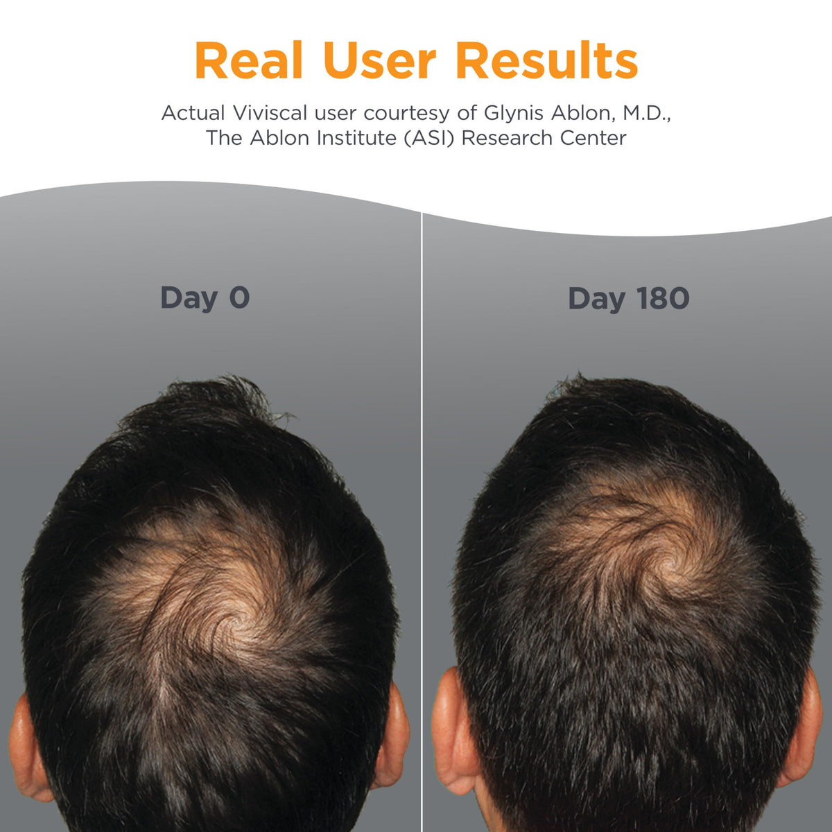 Viviscal Men's Hair Growth Supplements tablets on a surface