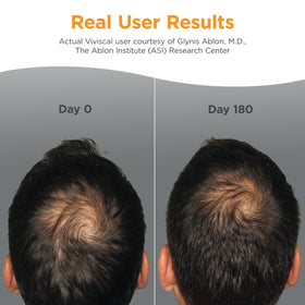 Viviscal Men's Hair Growth Supplements tablets on a surface