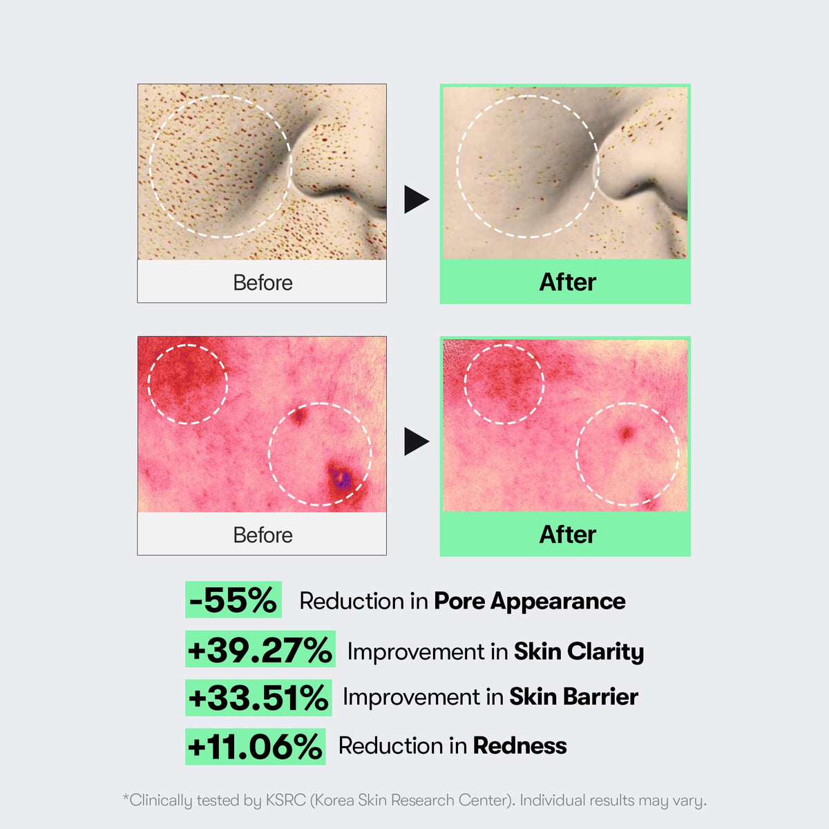 VT COSMETICS CICA Reedle Shot 100 Microneedling Serum ingredients list